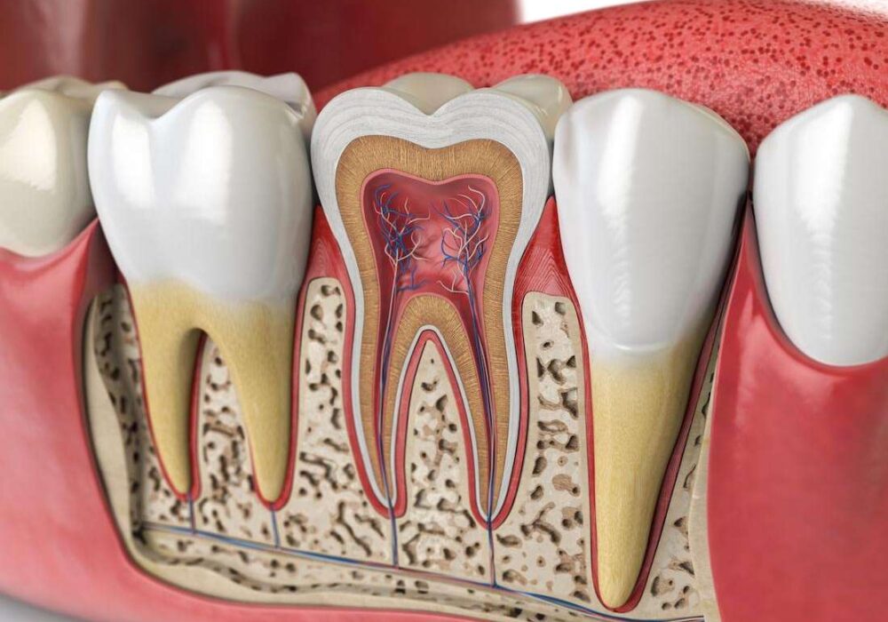 Endodontie, Zahnarzt Trier - Welschbillig