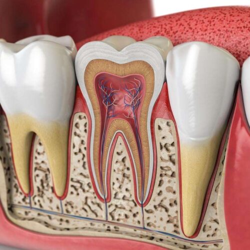 Endodontie, Zahnarzt Trier - Welschbillig